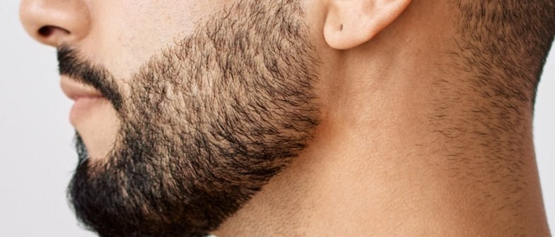 Beard Hair Transplant in Dubai: Precision Beard Crafting